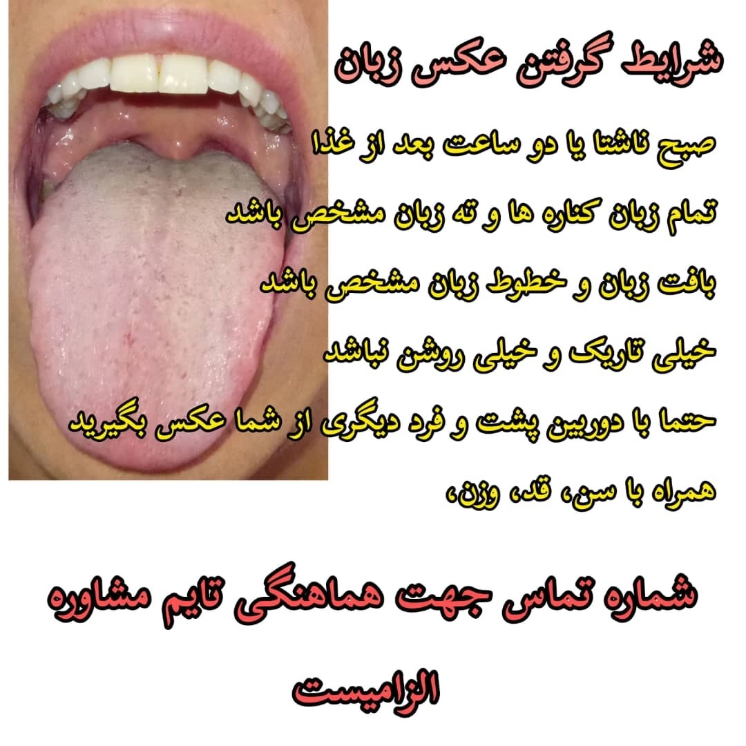 تشخیص بیماری از زبان  کاظمی رشت