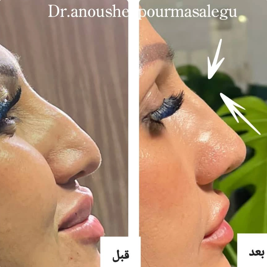 کلینیک زیبایی دکتر انوشه پور مسئله گو