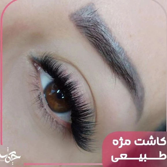 کاشت مژه