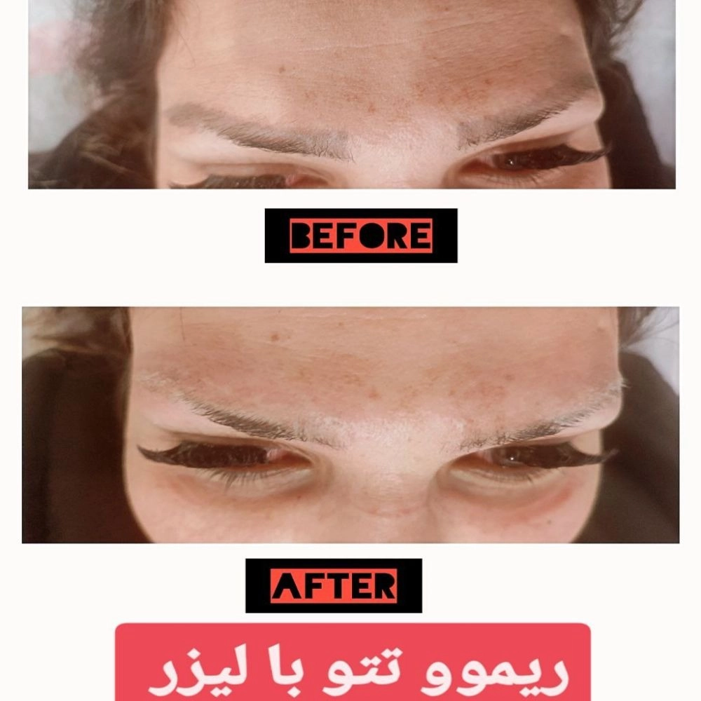 1764231086786.webp