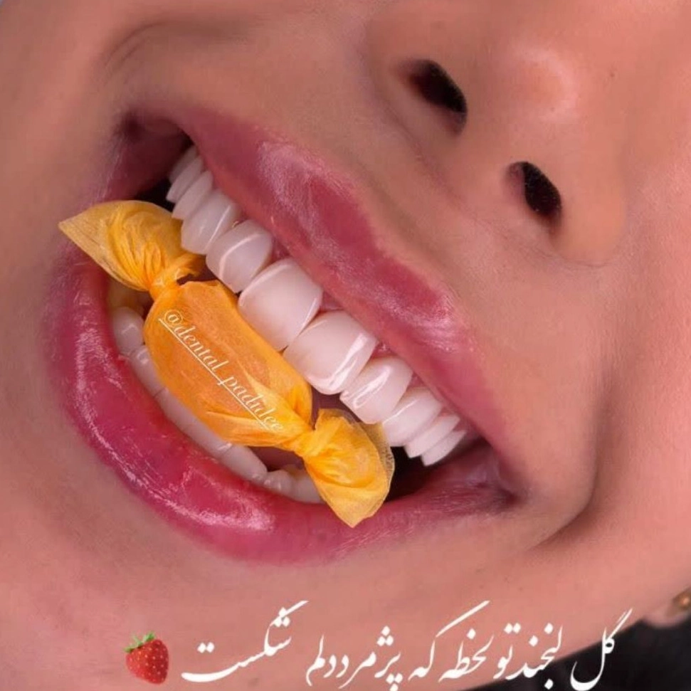 1778564632588.webp