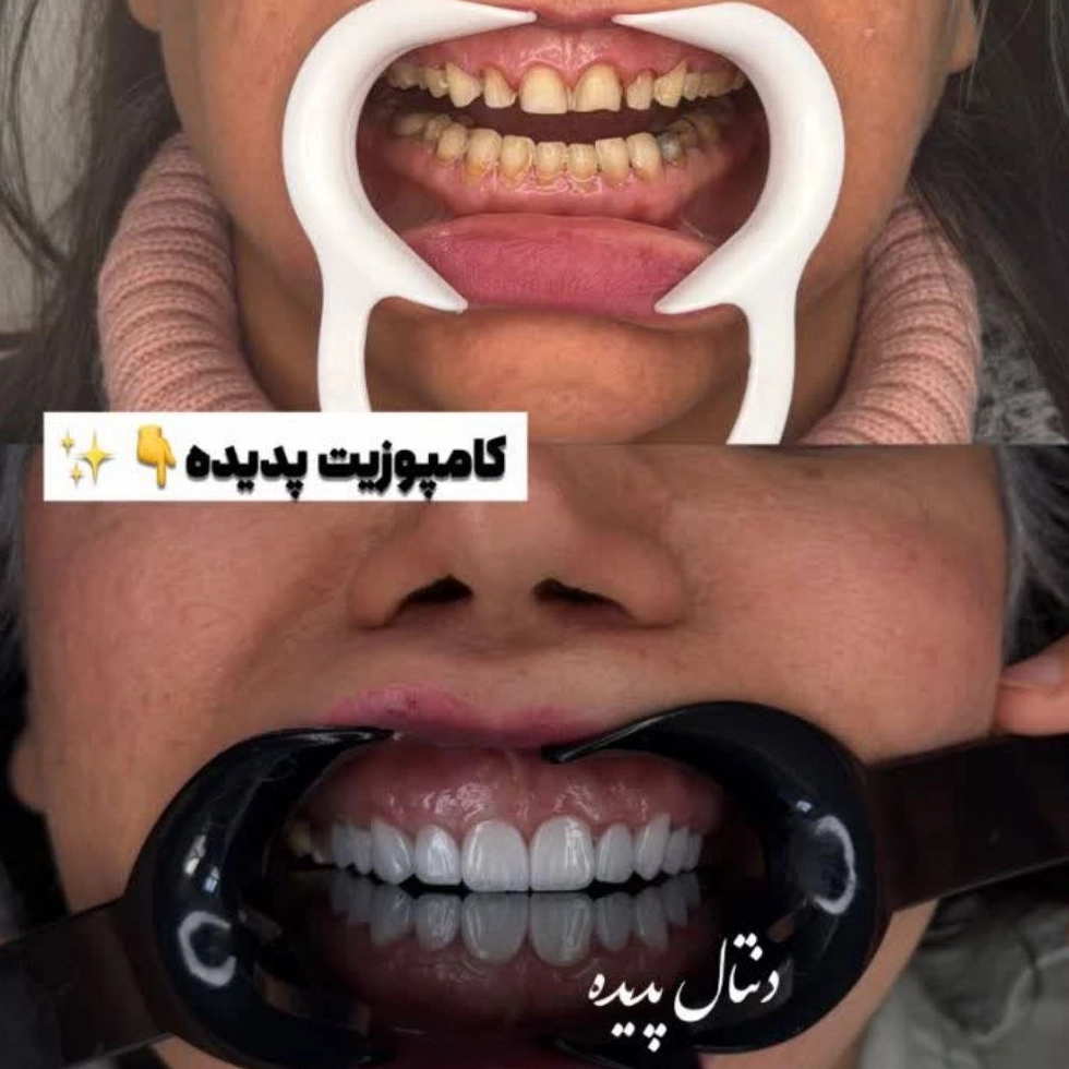 1779521916885.webp
