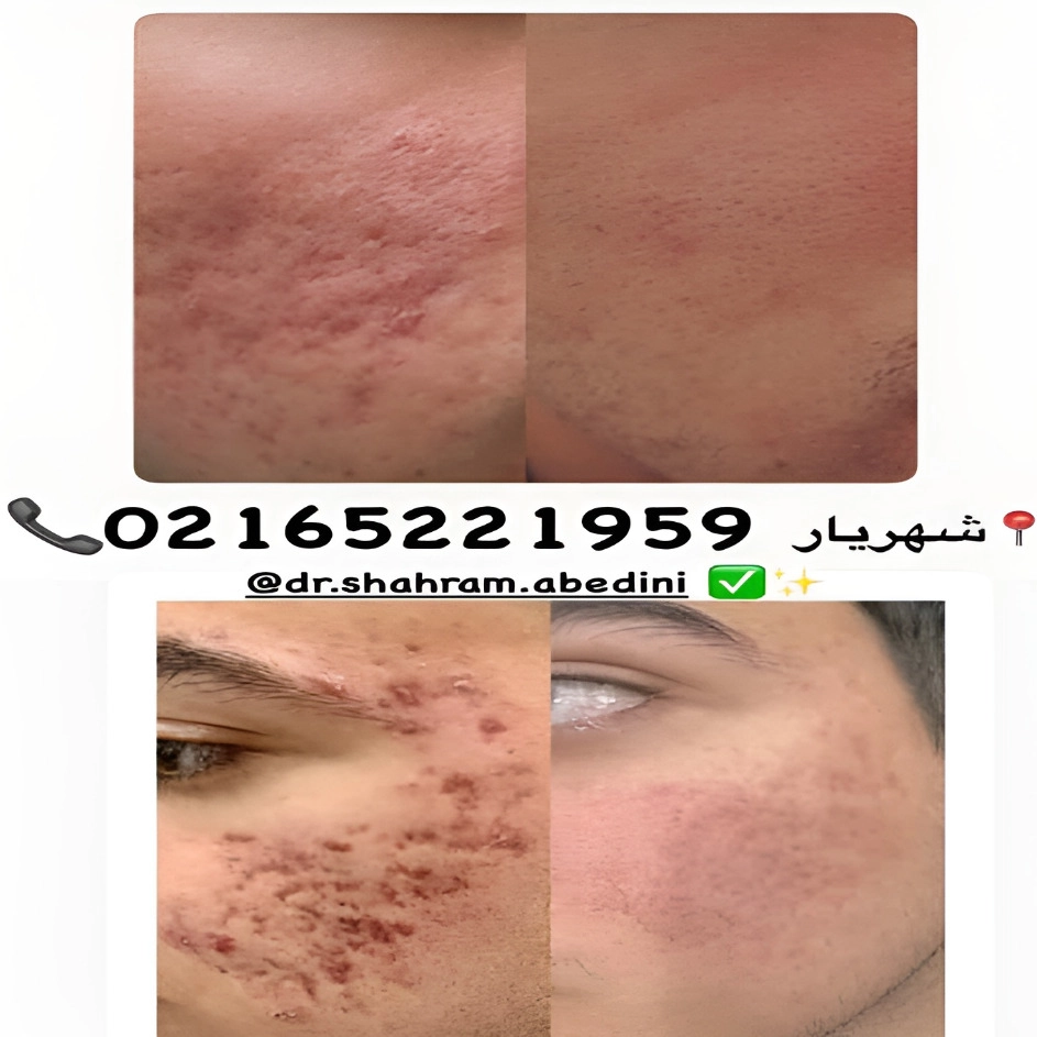 1785138575644.webp